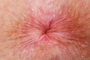 Original 3000 px/ 2000 px