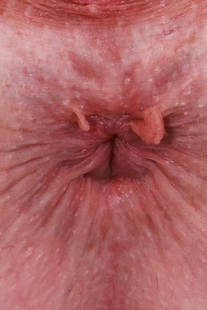 Original 2731 px/ 4096 px