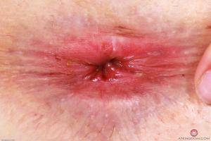 Original 3000 px/ 2000 px