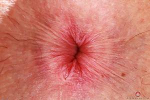 Original 3000 px/ 2000 px