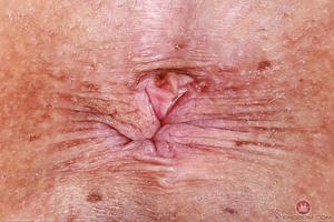 Original 5000 px/ 3333 px