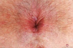 Original 3000 px/ 2000 px