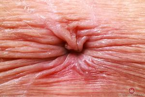 Original 5000 px/ 3333 px