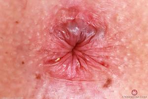 Original 5000 px/ 3333 px