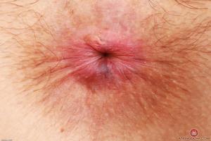 Original 3000 px/ 2000 px