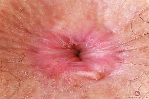 Original 3000 px/ 2000 px