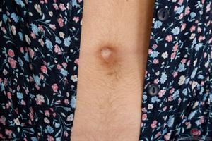 Original 3000 px/ 2000 px