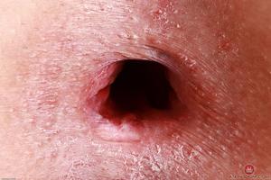 Original 3000 px/ 2000 px