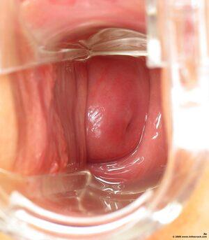 Original 1400 px/ 1600 px