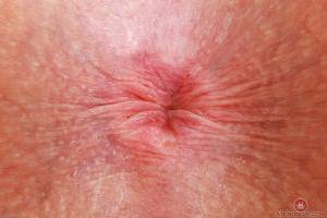 Original 3000 px/ 2000 px