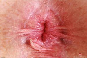 Original 3000 px/ 2000 px