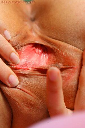 Original 981 px/ 1472 px