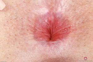 Original 3000 px/ 2000 px