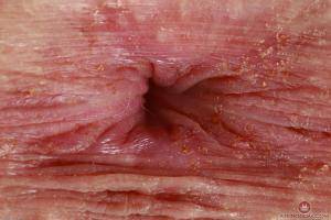 Original 3000 px/ 2000 px