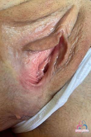 Original 854 px/ 1280 px