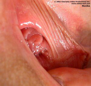 Original 813 px/ 768 px