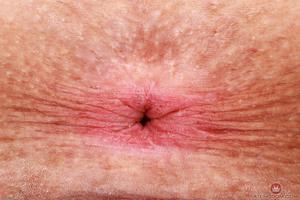 Original 3000 px/ 2001 px