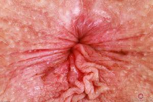 Original 3000 px/ 2000 px