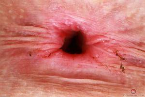 Original 3000 px/ 2000 px