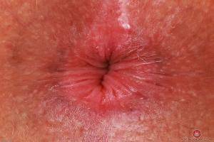 Original 3000 px/ 2000 px