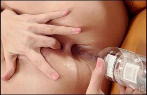 Original 1616 px/ 1053 px