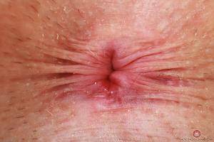 Original 3000 px/ 2000 px