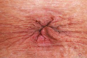 Original 3000 px/ 2000 px