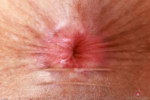 Original 3000 px/ 2000 px