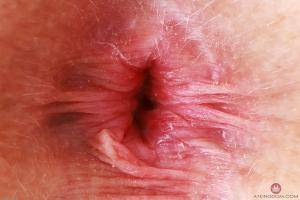 Original 3000 px/ 2000 px