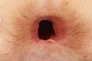 Original 3000 px/ 1999 px