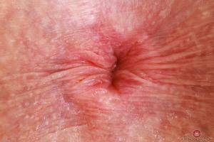 Original 3000 px/ 2000 px