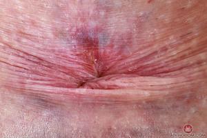 Original 5000 px/ 3334 px