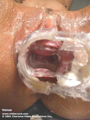 Original 576 px/ 768 px