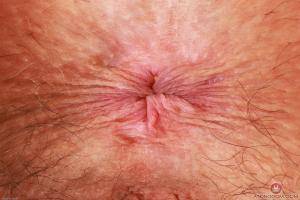 Original 3000 px/ 2000 px