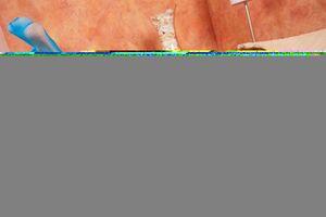 Original 3000 px/ 1996 px