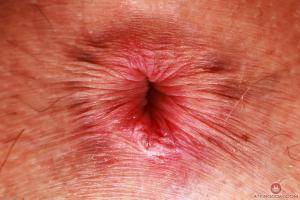 Original 3000 px/ 2000 px