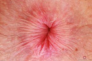 Original 3000 px/ 2000 px