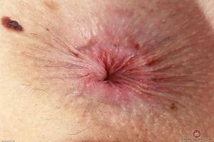 Original 3000 px/ 2000 px