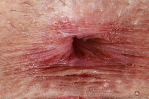 Original 3000 px/ 2000 px