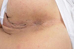 Original 3000 px/ 2000 px