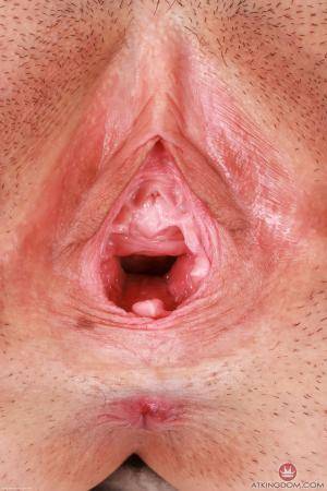 Original 2000 px/ 3000 px