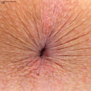 Original 1400 px/ 1400 px