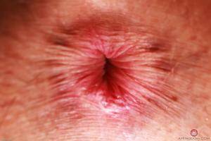 Original 3000 px/ 2000 px