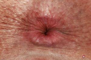 Original 3000 px/ 2000 px