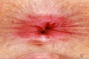 Original 3000 px/ 2000 px