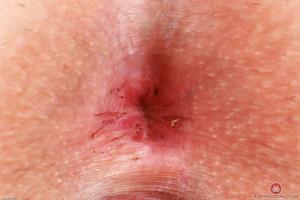 Original 3000 px/ 2001 px