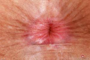 Original 3000 px/ 2000 px