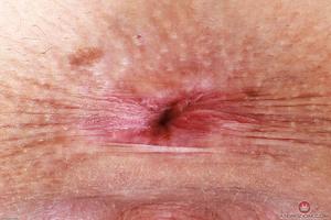 Original 3000 px/ 2000 px