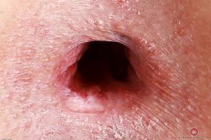 Original 3000 px/ 2000 px