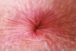 Original 3000 px/ 2000 px